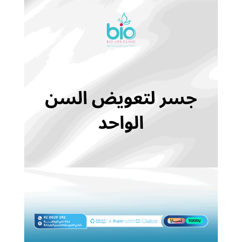 جسر لتعويض السن الواحد
