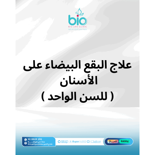 علاج البقع البيضاء على الأسنان ( للسن الواحد )