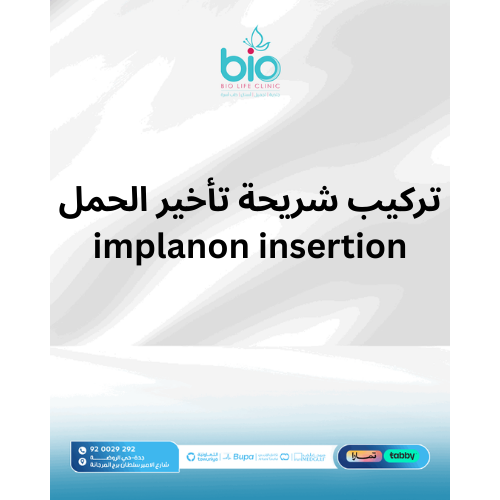 تركيب شريحة تأخير الحمل  - implanon insertion